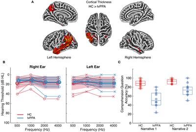 Cortical Tracking of the Speech Envelope in Logopenic Variant Primary Progressive Aphasia